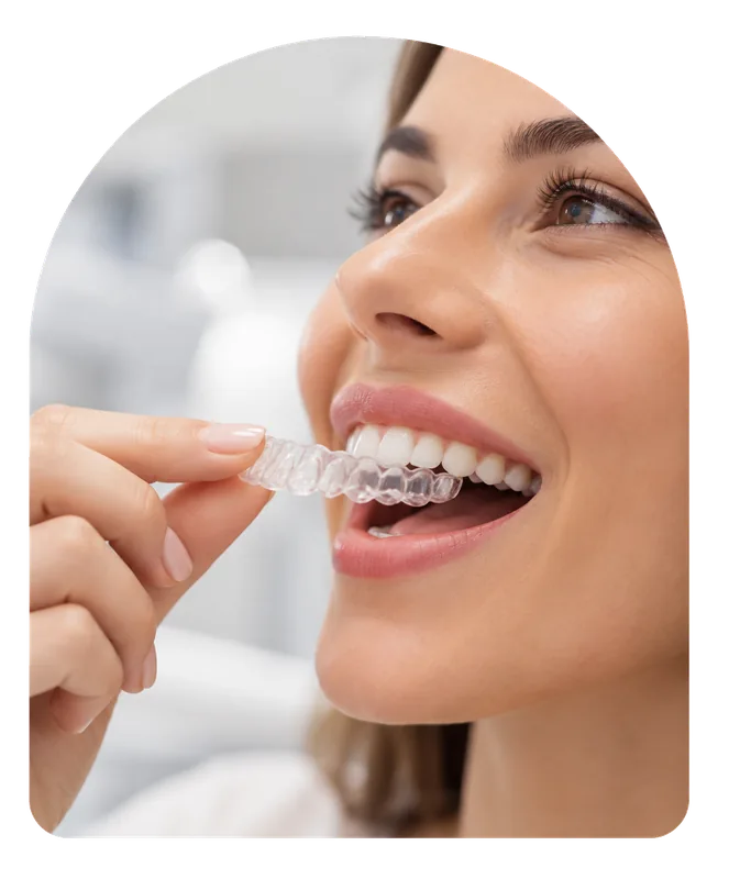 Zakładanie przezroczystej nakładki Invisalign